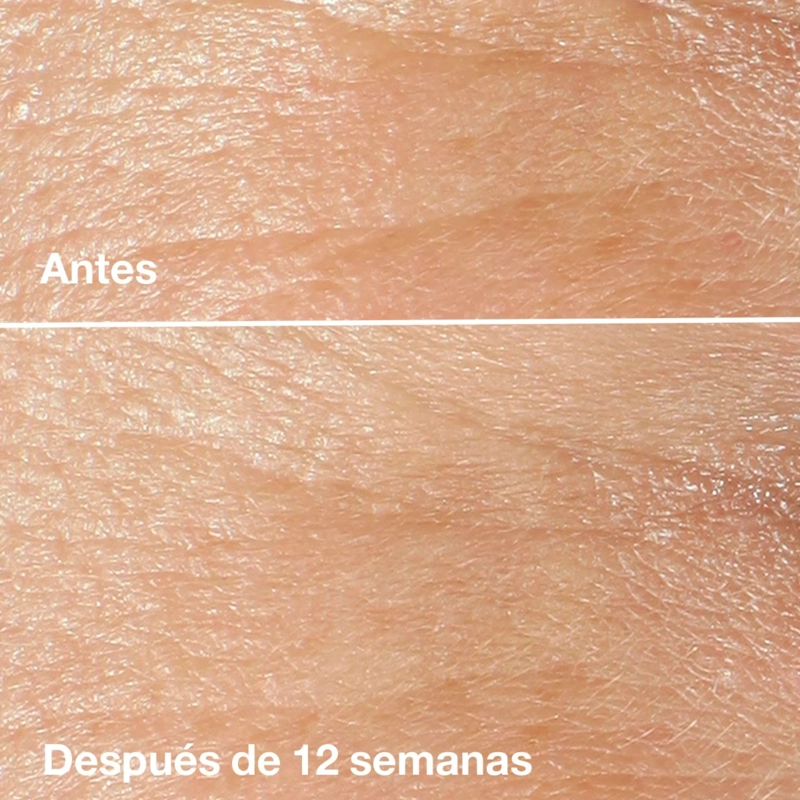 CONTORNO DE OJOS CLINIQUE PARA ANTIARRUGAS SMART CLINICAL REPAIR 15ML - 3