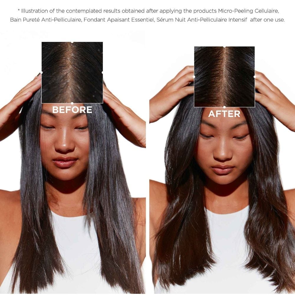MASCARILLA SYMBIOSE REVITALISANT ESSENTIEL PARA CABELLO DAÑADO PROPENSO A LA CASPA200ML - 3