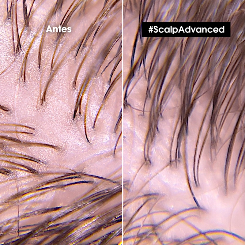 SHAMPOO EN GEL QUE PURIFICA EL CUERO CABELLUDO Y LA FIBRA DE RESIDUOS, SUDOR Y GRASA PARA UNA SENSACIÓN MÁS FRESCA Y LIMPIA SCALP ADVANCED ANTI-OILINESS 500 ML - 2