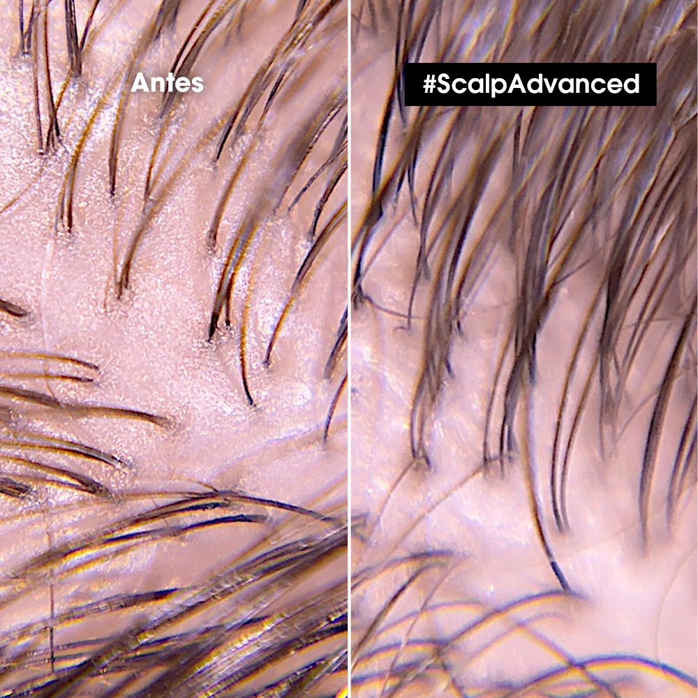 ARCILLA MULTIUSOS SCALP ADVANCED ANTI-OILINESS 2-IN-1 - 2