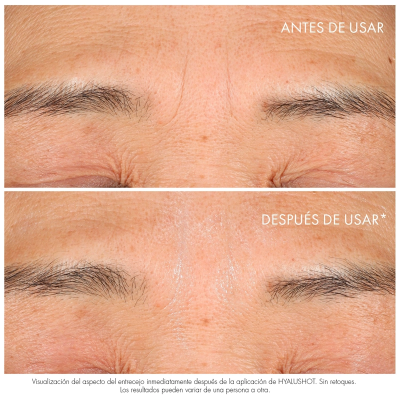 DIOR CAPTURE TOTALE HYALUSHOT 15ML - 4