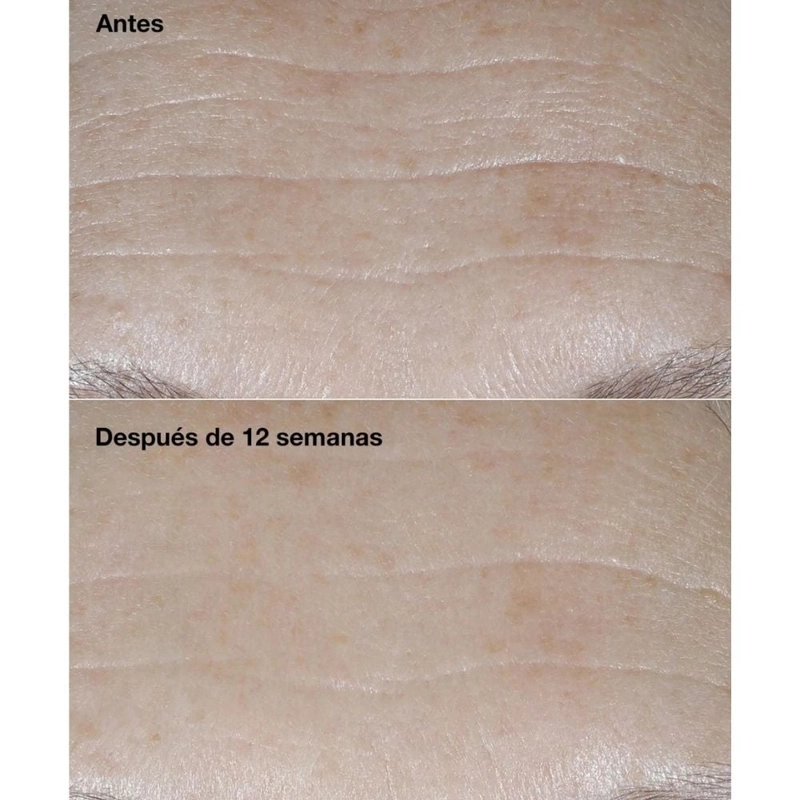 HIDRATANTE FACIAL CLINIQUE REPARADORA ANTIARRUGAS SMART CLINICAL REPAIR SPF30 50ML - 4