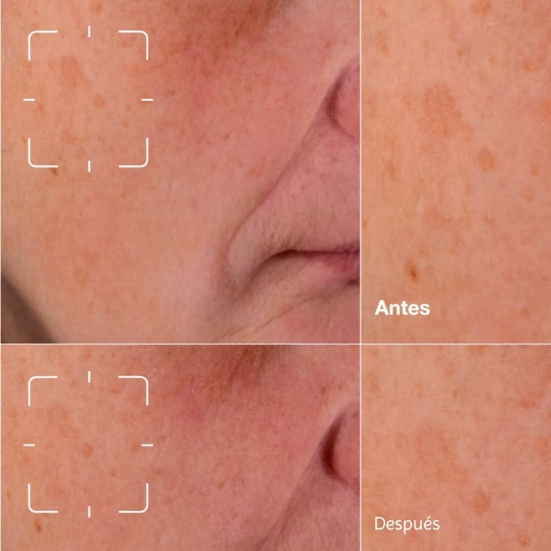 SUERO ROSTRO CLINIQUE 30ML EVEN BETTER CLINICAL ANTIMANCHAS - 11