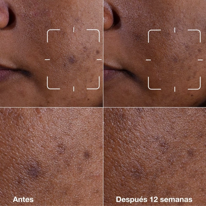 SUERO ROSTRO CLINIQUE 30ML EVEN BETTER CLINICAL ANTIMANCHAS - 10