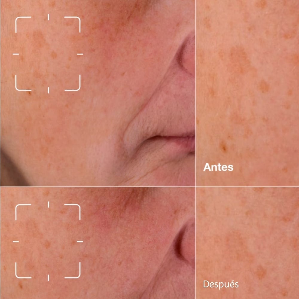 SUERO ROSTRO CLINIQUE 50ML EVEN BETTER CLINICAL ANTIMANCHAS - 11