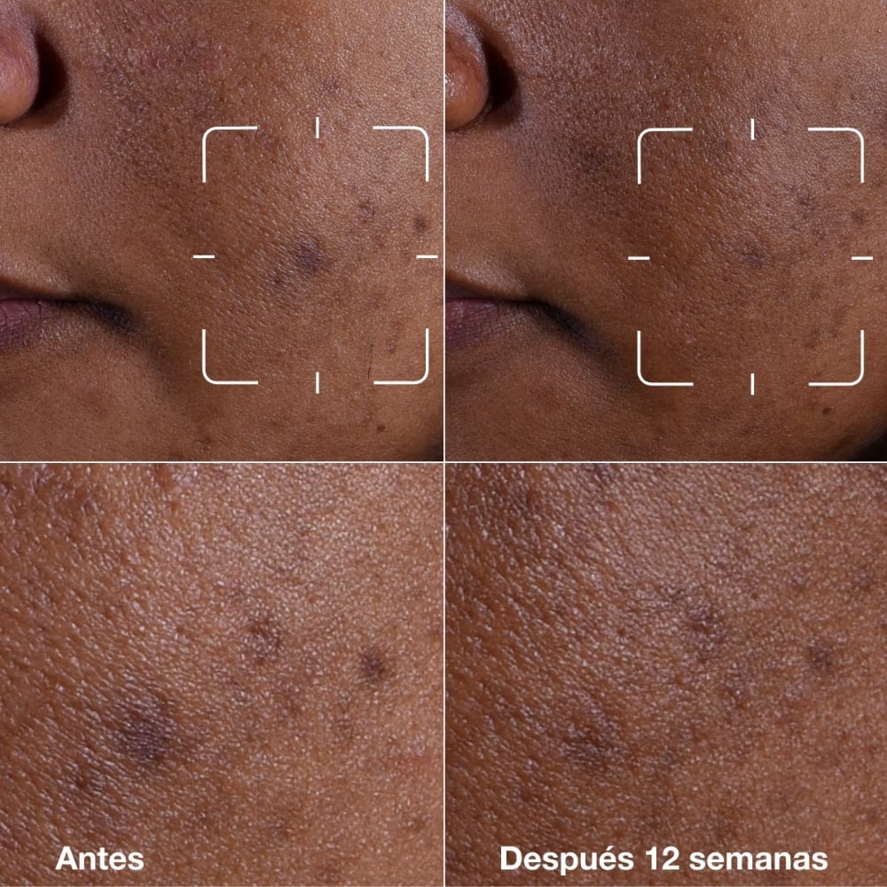 SUERO ROSTRO CLINIQUE 50ML EVEN BETTER CLINICAL ANTIMANCHAS - 10