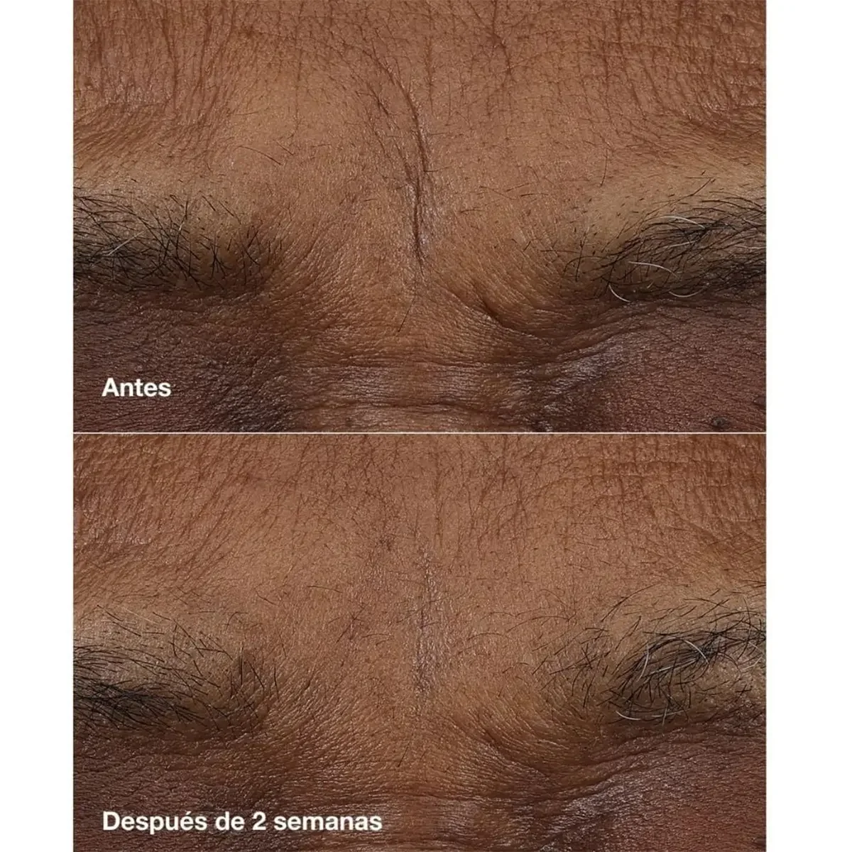 SET TRATAMIENTO CLINIQUE SMART ANTIEDAD DIA Y NOCHE - 11