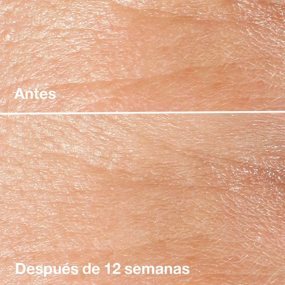 SET DE-AGING EXPERTS CLINIQUE - 3