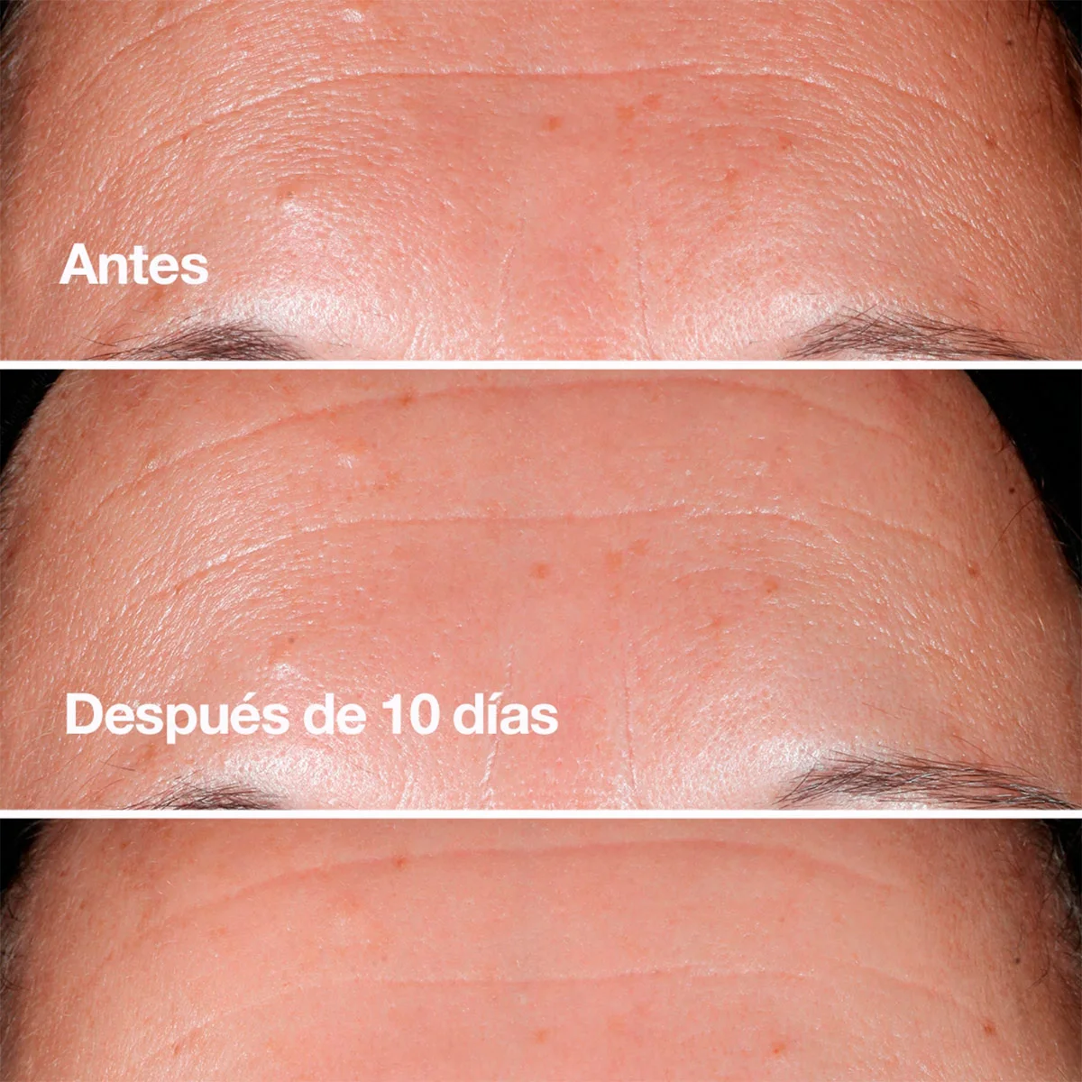 SET WRINKE FLIGHTING ROUTINE CLINIQUE - 3
